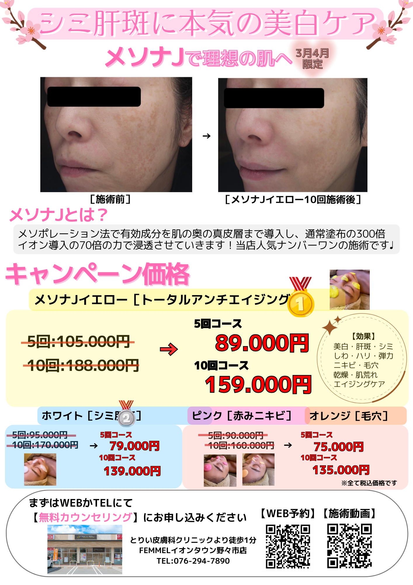 \ 2か月間限定 / メソナJで理想の肌へ🌸キャンペーンのイメージ画像